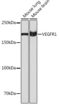 VEGFR1/Flt-1 Rabbit anti-Mouse, Rat, Clone: 7F1A3, Novus Biologicals 20 &mu;g | Buy Online | Novus Biologicals | Fisher Scientific