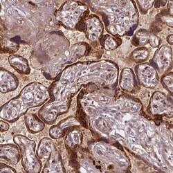 VEGFR1/Flt-1 Antibody (CL0345), Novus Biologicals:Antibodies:Primary Antibodies