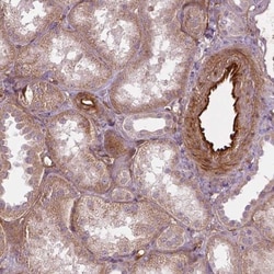 VEGFR1/Flt-1 Antibody (CL0345), Novus Biologicals:Antibodies:Primary Antibodies