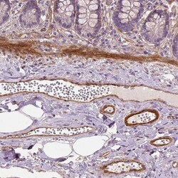 VEGFR1/Flt-1 Antibody (CL0345), Novus Biologicals:Antibodies:Primary Antibodies