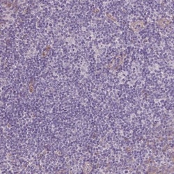 VEGFR1/Flt-1 Antibody (CL0345), Novus Biologicals:Antibodies:Primary Antibodies
