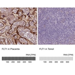 VEGFR1/Flt-1 Antibody (CL0345), Novus Biologicals:Antibodies:Primary Antibodies
