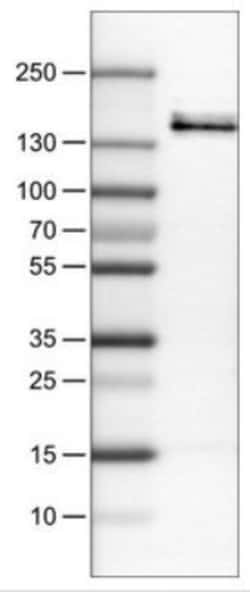 VEGFR1/Flt-1 Antibody (CL0345), Novus Biologicals:Antibodies:Primary Antibodies