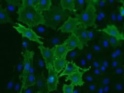 VEGFR1/Flt-1 Antibody (EWC) - Azide and BSA Free, Novus Biologicals:Antibodies:Primary