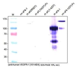 VEGFR1/Flt-1 Antibody (EWC) - Azide and BSA Free, Novus Biologicals:Antibodies:Primary