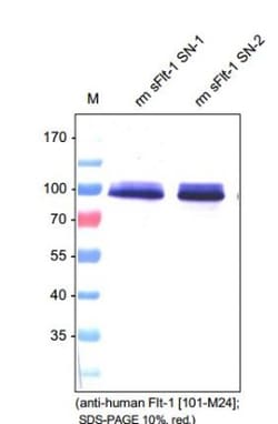 VEGFR1/Flt-1 Antibody (EWC) - Azide and BSA Free, Novus Biologicals:Antibodies:Primary