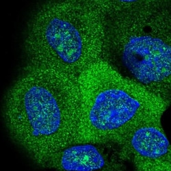 VEPH1 Antibody, Novus Biologicals 0.1mL; Unlabeled:Antibodies, Polyclonal