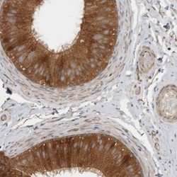 VEPH1 Antibody, Novus Biologicals 0.1mL; Unlabeled:Antibodies, Polyclonal
