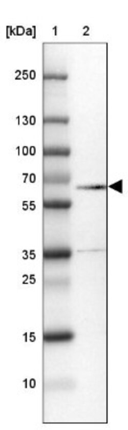 VEZF1 Antibody, Novus Biologicals 0.1mL; Unlabeled:Antibodies, Polyclonal