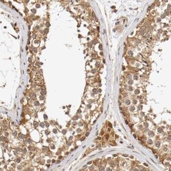 VEZT Antibody, Novus Biologicals 0.1mL; Unlabeled:Antibodies, Polyclonal