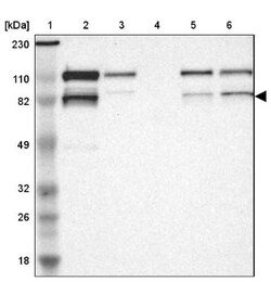 VEZT Antibody, Novus Biologicals 0.1mL; Unlabeled:Antibodies, Polyclonal