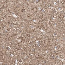 VGCNL1 Antibody, Novus Biologicals:Antibodies:Primary Antibodies
