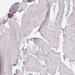 VGLL1 Antibody, Novus Biologicals 25 μL, Unlabeled:Antibodies, Polyclonal