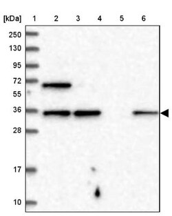 VGLL4 Antibody, Novus Biologicals 0.1 mL | Buy Online | Novus Biologicals | Fisher Scientific