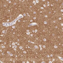 VGLUT1 Antibody, Novus Biologicals 0.1mL; Unlabeled:Antibodies, Polyclonal