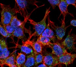 VGLUT2 Antibody (S29-29), Novus Biologicals:Antibodies:Primary Antibodies