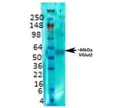 VGLUT2 Antibody (S29-29), Novus Biologicals:Antibodies:Primary Antibodies