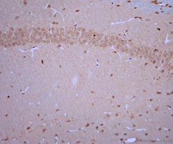 VGluT3 Antibody, Novus Biologicals 0.025 mL; Unconjugated:Antibodies, Polyclonal