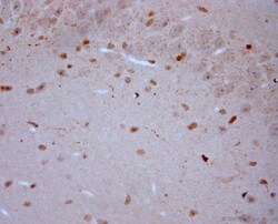 VGluT3 Antibody, Novus Biologicals 0.025 mL; Unconjugated:Antibodies, Polyclonal