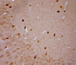 VGluT3 Antibody, Novus Biologicals 0.025 mL; Unconjugated:Antibodies, Polyclonal