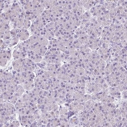 VIAAT/SLC32A1/VGAT Antibody, Novus Biologicals:Antibodies:Primary Antibodies