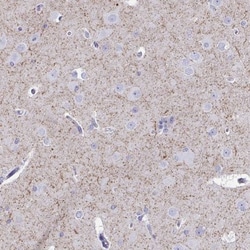 VIAAT/SLC32A1/VGAT Antibody, Novus Biologicals:Antibodies:Primary Antibodies