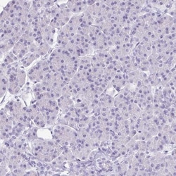 VIAAT/SLC32A1/VGAT Antibody, Novus Biologicals:Antibodies:Primary Antibodies