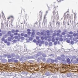 VIAAT/SLC32A1/VGAT Antibody, Novus Biologicals:Antibodies:Primary Antibodies