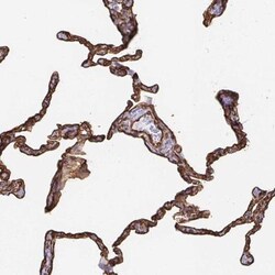 VIPR2/VPAC2 Antibody, Novus Biologicals 25 &mu;L, Unlabeled:Antibodies,