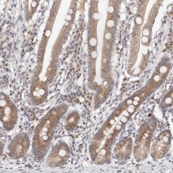 VIPAR Antibody, Novus Biologicals:Antibodies:Primary Antibodies