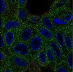 VKORC1 Antibody, Novus Biologicals 0.1mL; Unlabeled:Antibodies, Polyclonal
