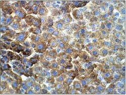 VKORC1 Antibody, Novus Biologicals 100 &mu;g | Buy Online | Novus Biologicals | Fisher Scientific
