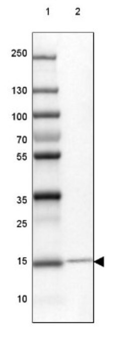 VKORC1 Antibody, Novus Biologicals 0.1mL; Unlabeled:Antibodies, Polyclonal