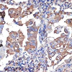 VPS11 Rabbit anti-Human, Mouse, Clone: 8L3D8, Novus Biologicals:Antibodies:Primary