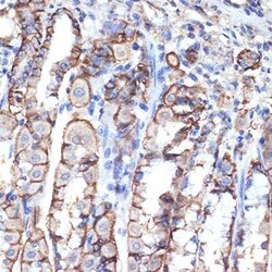 VPS11 Rabbit anti-Human, Mouse, Clone: 8L3D8, Novus Biologicals:Antibodies:Primary