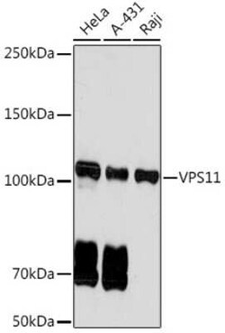VPS11 Rabbit anti-Human, Mouse, Clone: 8L3D8, Novus Biologicals:Antibodies:Primary
