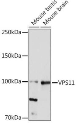 VPS11 Rabbit anti-Human, Mouse, Clone: 8L3D8, Novus Biologicals:Antibodies:Primary