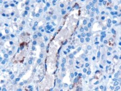 VPS25 Antibody, Novus Biologicals 0.1mg; Unlabeled:Antibodies, Polyclonal