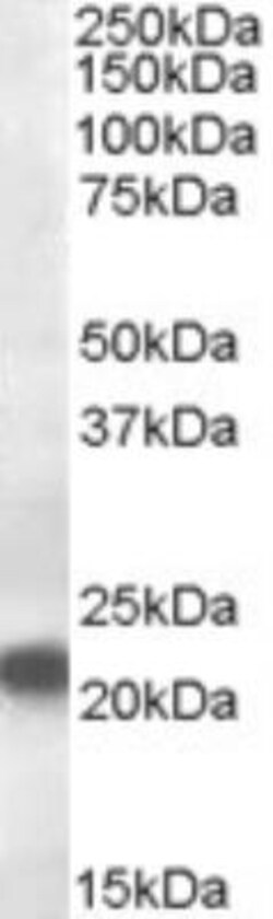 VPS25 Antibody, Novus Biologicals 0.1mg; Unlabeled:Antibodies, Polyclonal