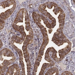 VPS26A Antibody (CL2287), Novus Biologicals 0.1mL; Unlabeled:Antibodies,