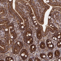 VPS26A Antibody (CL2287), Novus Biologicals 0.1mL; Unlabeled:Antibodies,