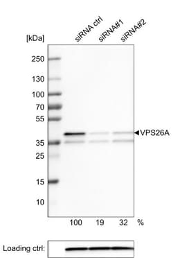 VPS26A Antibody (CL2287), Novus Biologicals 0.1mL; Unlabeled:Antibodies,