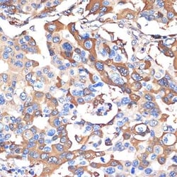 VPS28 Rabbit anti-Human, Mouse, Rat, Clone: 4F8M0, Novus Biologicals:Antibodies:Primary