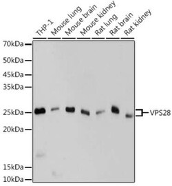 VPS28 Rabbit anti-Human, Mouse, Rat, Clone: 4F8M0, Novus Biologicals:Antibodies:Primary