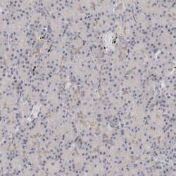 VPS28 Antibody, Novus Biologicals 0.1 mL | Buy Online | Novus Biologicals | Fisher Scientific