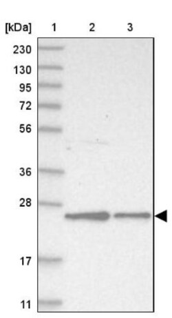 VPS28 Antibody, Novus Biologicals 0.1 mL | Buy Online | Novus Biologicals | Fisher Scientific