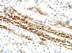 VPS29 Antibody, Novus Biologicals 100 &mu;g; Unconjugated:Antibodies, Polyclonal