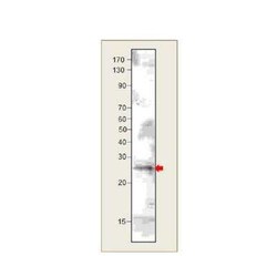 VPS29 Antibody, Novus Biologicals 100 &mu;g; Unconjugated:Antibodies, Polyclonal