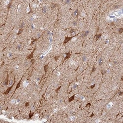 VPS33B Antibody, Novus Biologicals 25 &mu;L; Unlabeled:Antibodies, Polyclonal