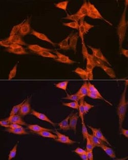 VPS34 Rabbit anti-Human, Mouse, Rat, Clone: 9U5O3, Novus Biologicals 100
